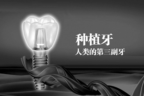 做种植牙需要磨牙吗