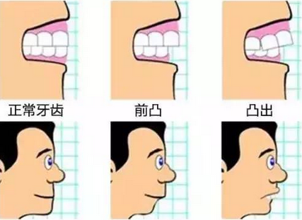 牙周病患者能做牙齿矫正吗