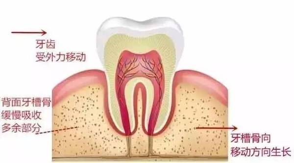 牙齿矫正的较佳年龄,隐形矫正牙齿,隐适美牙齿矫正
