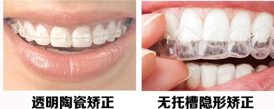 隐形矫正，别人真的看不出来吗？