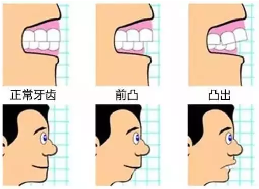 大学生做牙齿矫正什么方法比较好