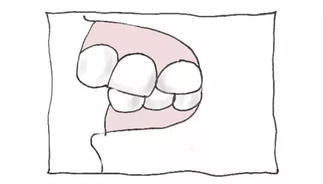 前突