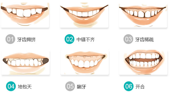 什么样的牙齿需要矫正