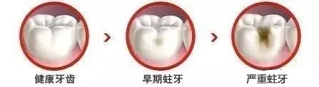 补牙