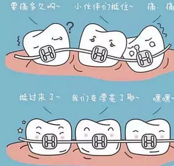牙齿矫正什么时候会疼