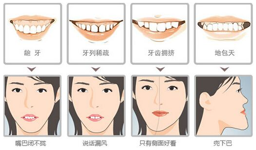 成年人牙齿不整齐